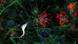 Formation of 3-D, functional neuronal networks in vitro